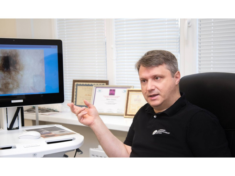 Gydytojų komanda atvira: odos vėžys dažniausiai diagnozuojamas 60-mečiams, kurie anuomet mėgo leisti laiką sode ar Palangos paplūdimyje