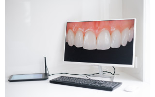 Technologijos, kurios grąžina šypseną: kaip 3D spausdinimas keičia odontologiją