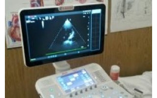 Palangos ligoninėje – modernus ultragarsinio tyrimo aparatas