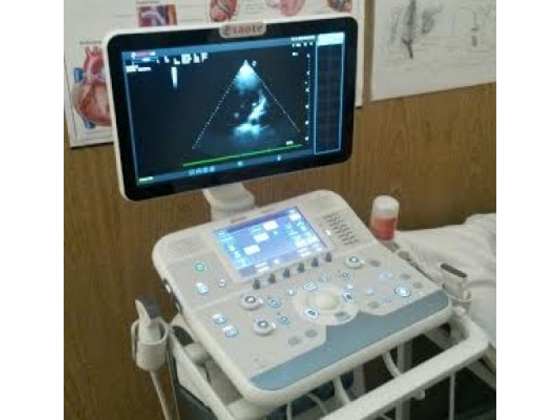 Palangos ligoninėje – modernus ultragarsinio tyrimo aparatas