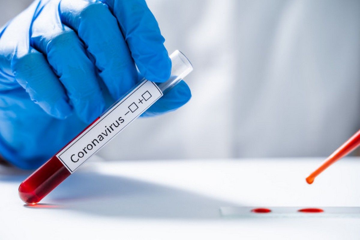 9 COVID-19 infekcijos atvejai yra susiję su židiniu Palangos reabilitacijos ligoninėje
