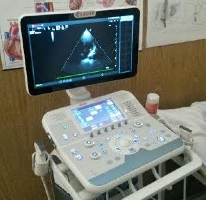 Palangos ligoninėje – modernus ultragarsinio tyrimo aparatas
