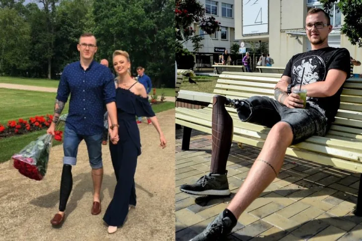 Kojos netekusio palangiškio stiprybė įkvepia: po tėčio mirties – pergalinga kova su vėžiu
