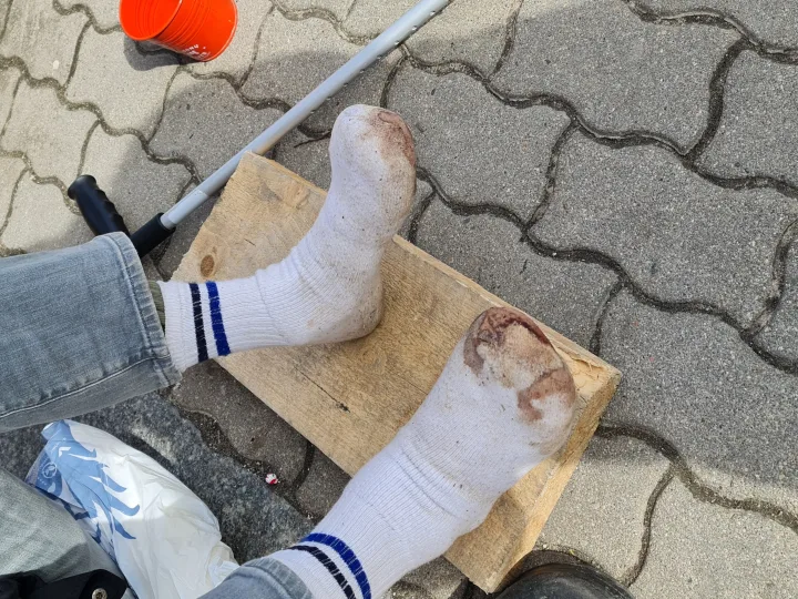 Palangos benamis Gintaras: „Kai per vasario šalčius nušalau kojas, pirštai nupuvo. Kai kaulai jau bolavo, apgramdžiau viską ir „nudžirinau“ pirštus“ – nuotrauka 1